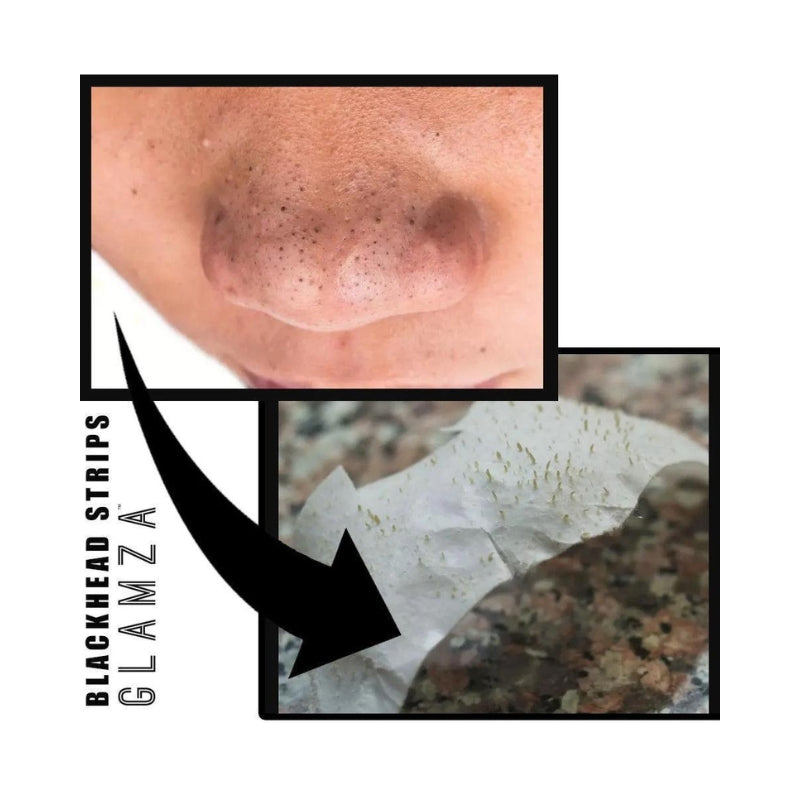 Deep Cleansing Nose Strips for Blackheads - My Vitamin Shop