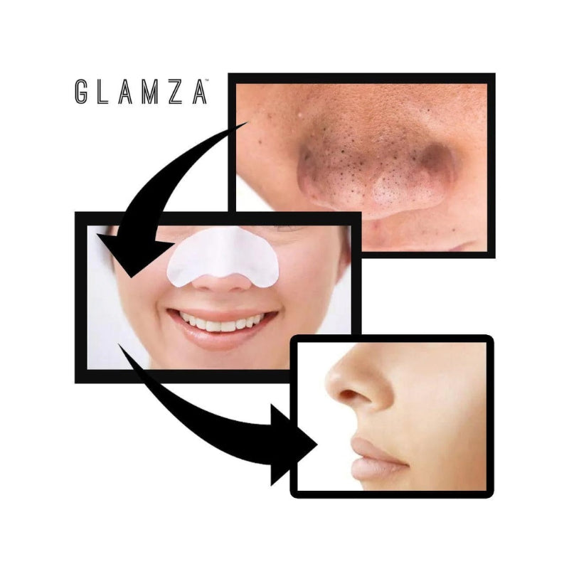 Deep Cleansing Nose Strips for Blackheads - My Vitamin Shop